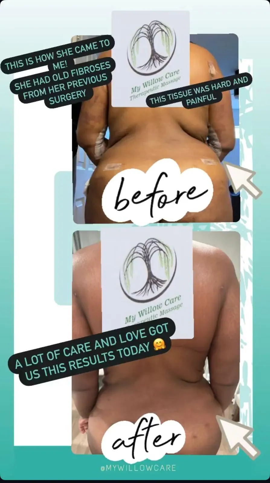 Client-submitted post-operative care progress image 1
