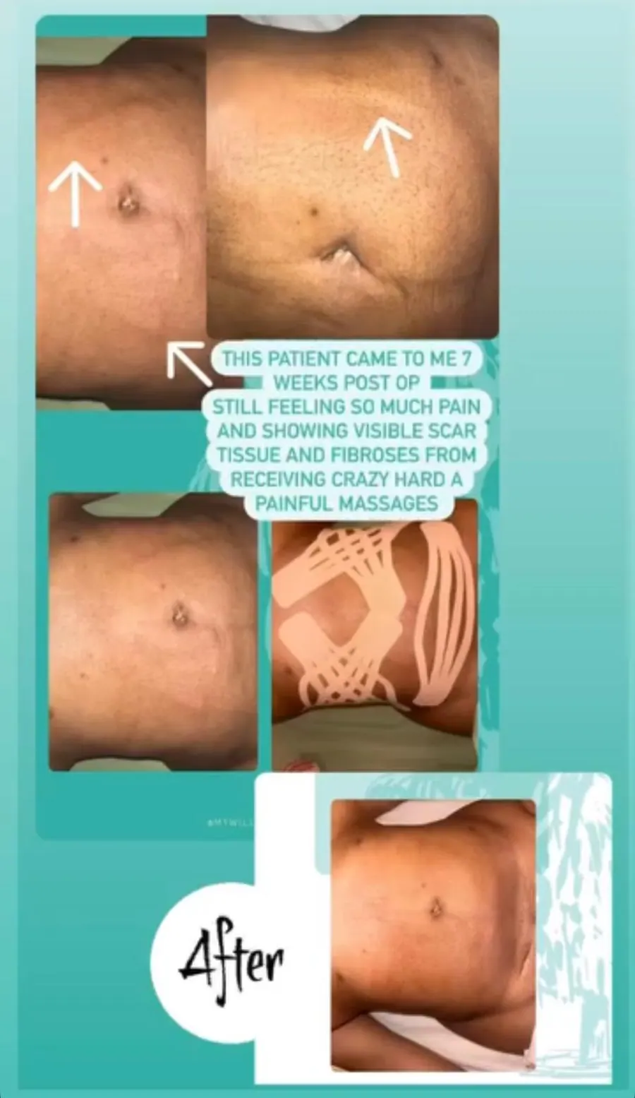 Client-submitted post-operative care progress image 2