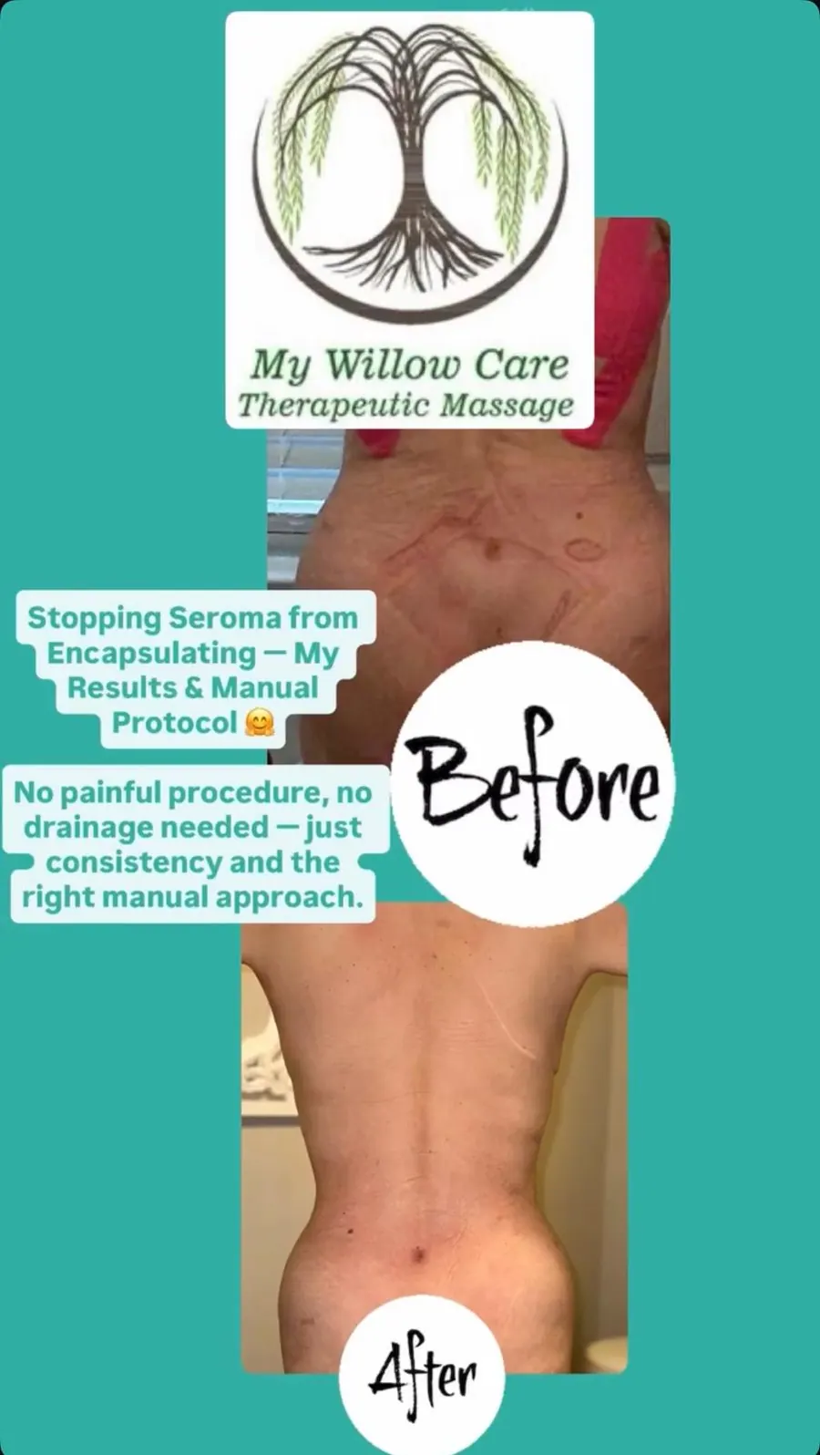 Client-submitted post-operative care progress image 3