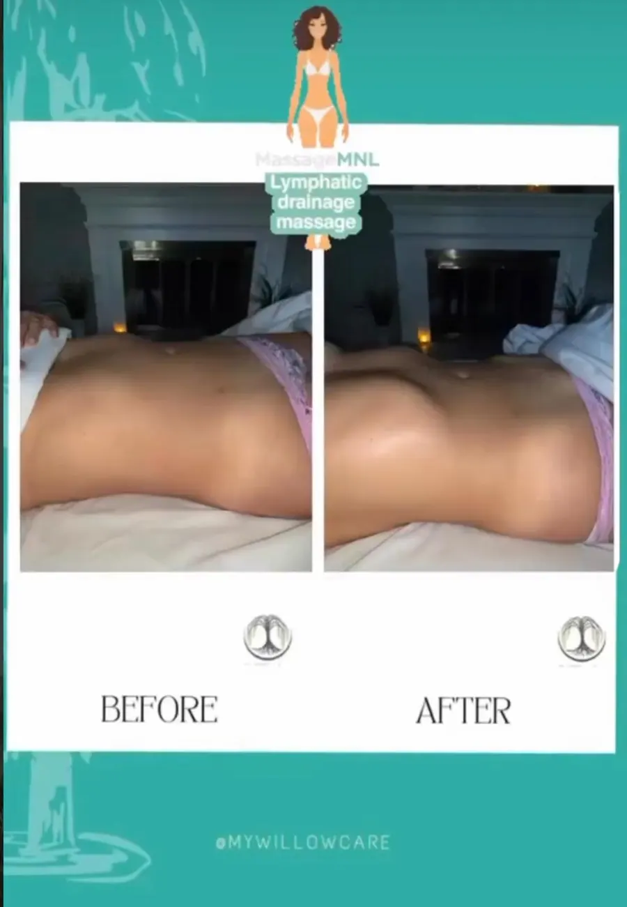Client-submitted post-operative care progress image 4