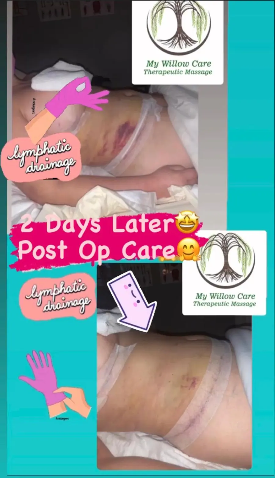 Client-submitted post-operative care progress image 5