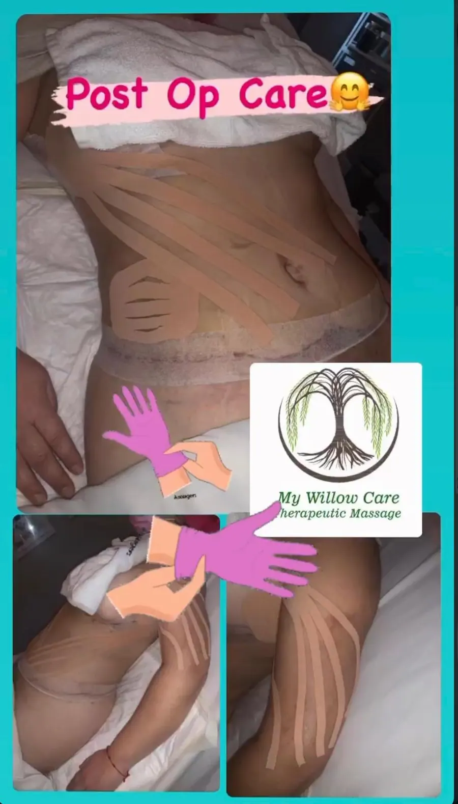 Client-submitted post-operative care progress image 6